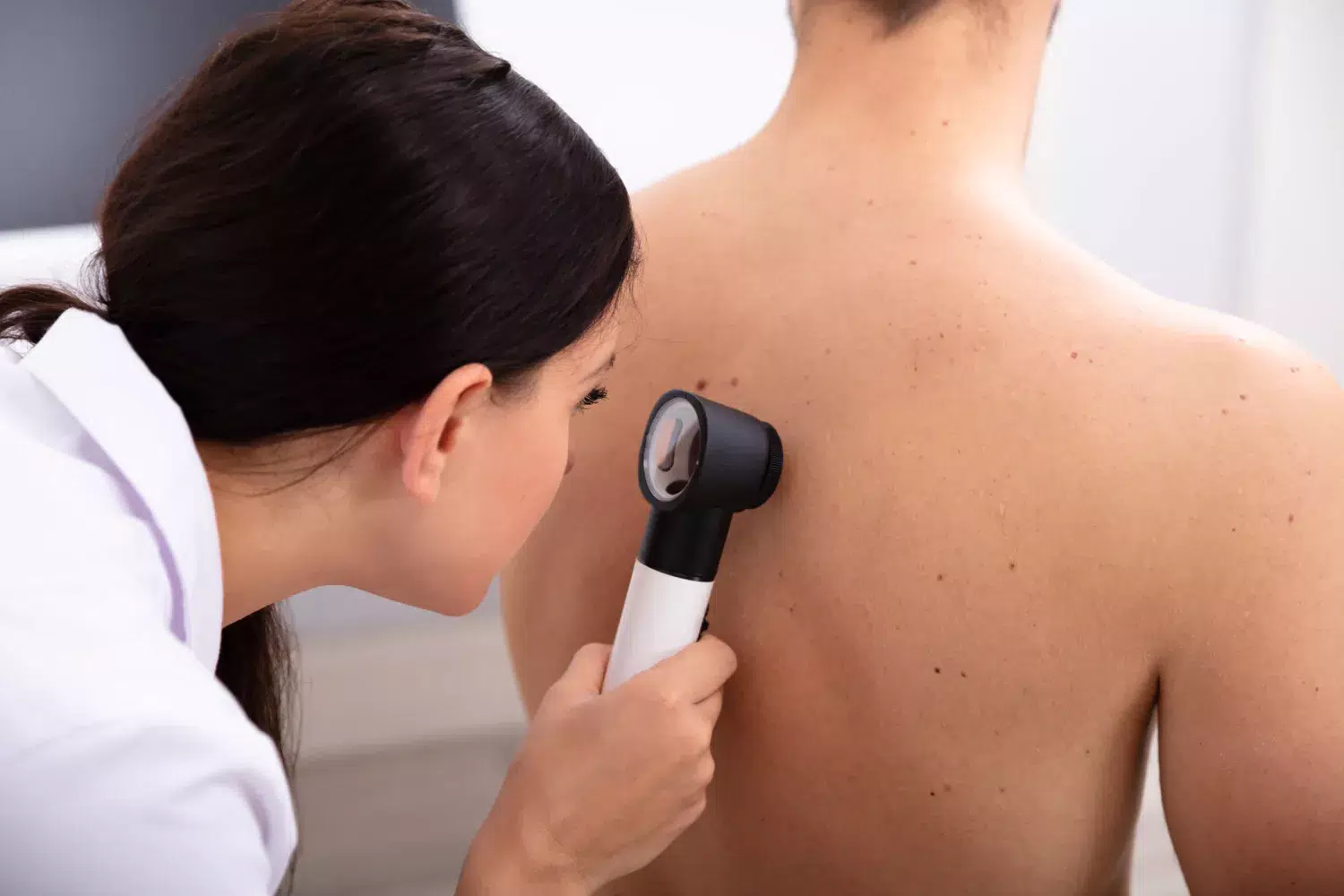 Photo of woman examining the skin on a man's back.