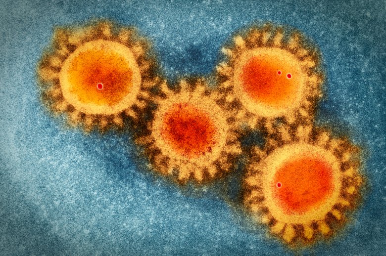 Colored visualisation of electron microscopy photo of the coronavirus COVID-19