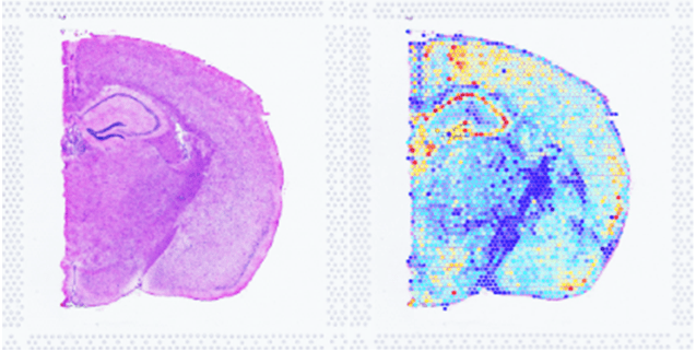 tissue section