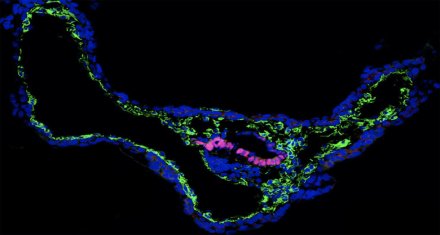 In vitro cultured non-human primate embryo from blastocyst to gastrulation