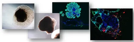 Karolinska Stem Cell Organoid
